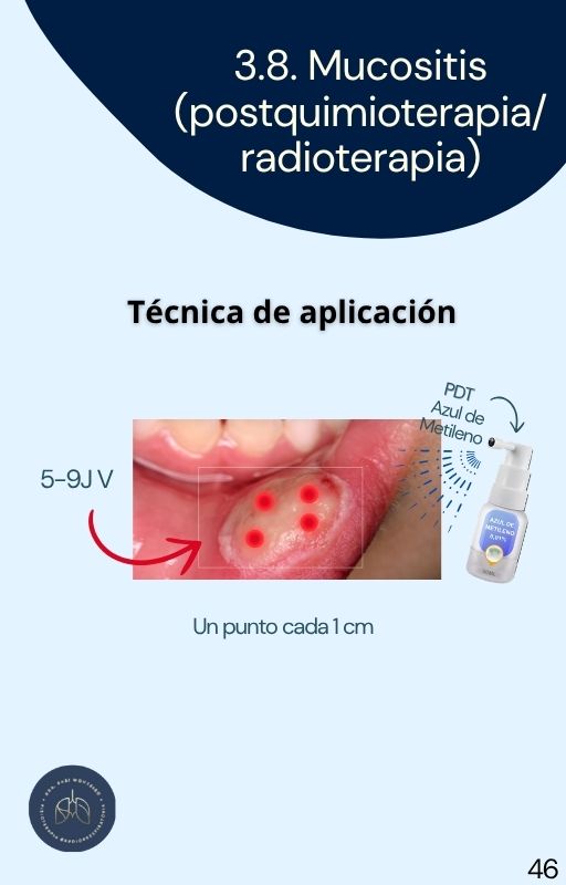 Espanhol (104)