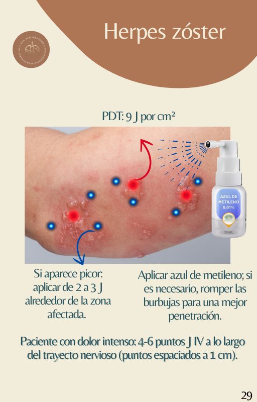 Espanhol (21)