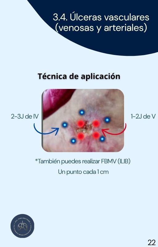 Espanhol (84)